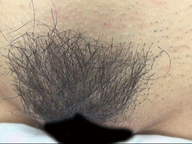 300人のまん毛3　サンプル画像14